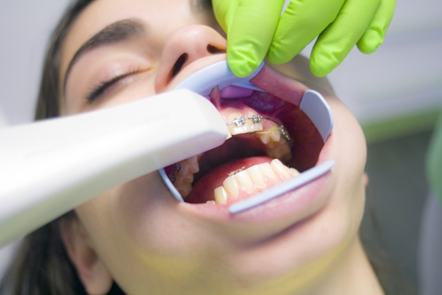 Gingivectomía en Guadalajara: Beneficios y cuidados postoperatorios