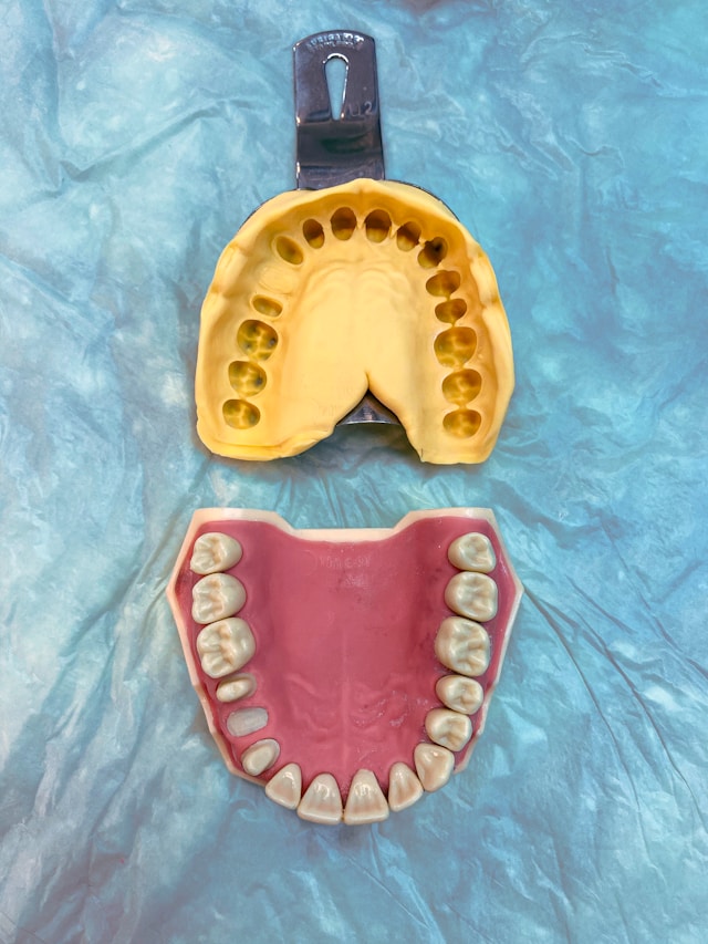4 Beneficios de usar una guarda miorrelajante para dientes
