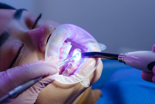 5 Indicaciones Post Cirugía Dental para ayudarte en el proceso