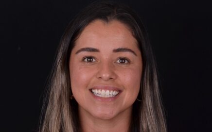 4 Beneficios de la Radiografía Panorámica Dental en el Diagnóstico