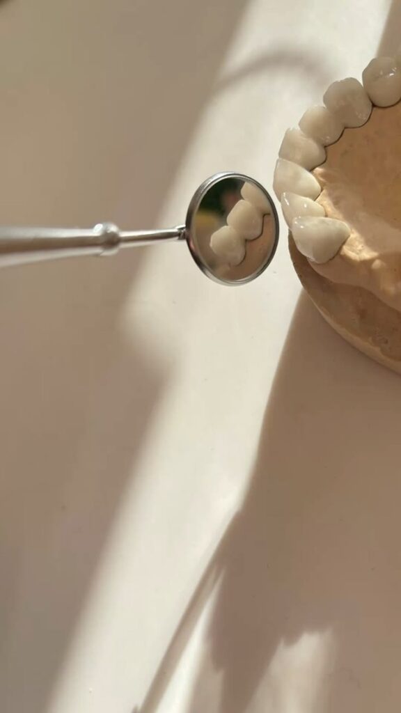 Lista de Consideraciones para Elegir Cerómeros Dentales