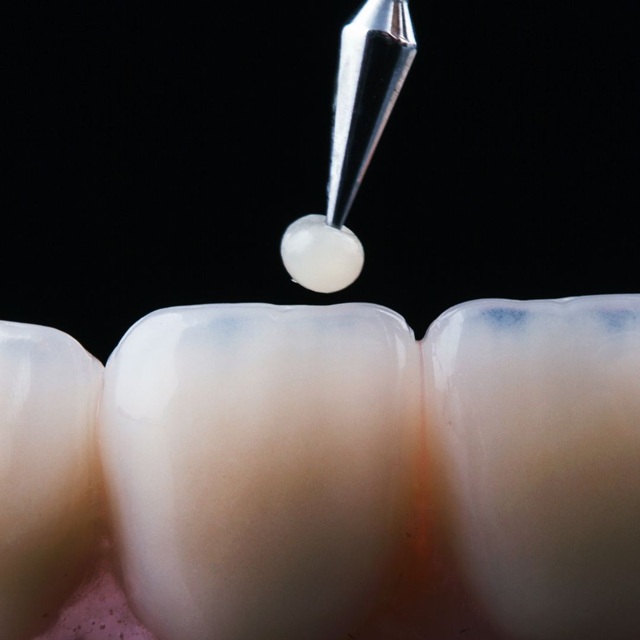 Cerómeros Dentales en México: Aplicaciones y Beneficios