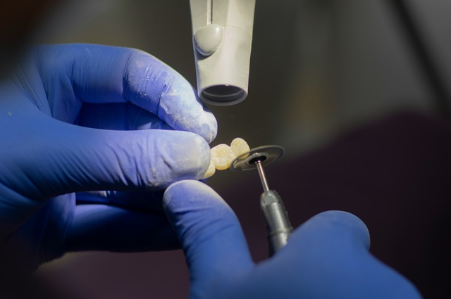 Ortoimplantes Dentales: Ventajas, Procedimiento y Cuidados