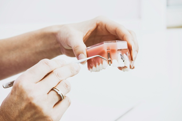 Ortoimplantes Dentales: Ventajas, Procedimiento y Cuidados