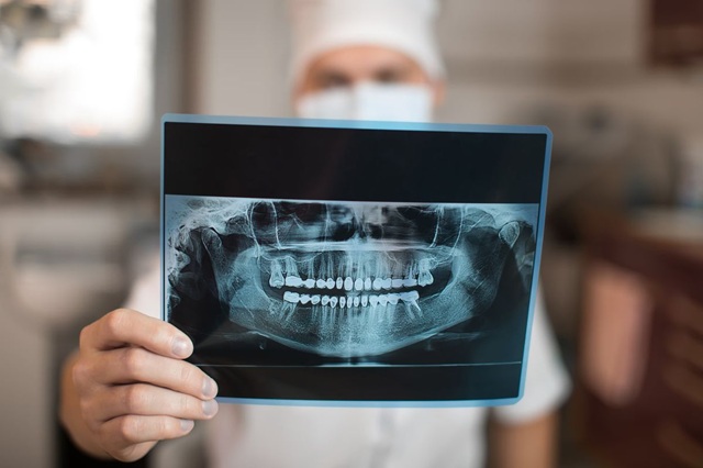 Odontólogo mostrando una radiografía panorámica dental