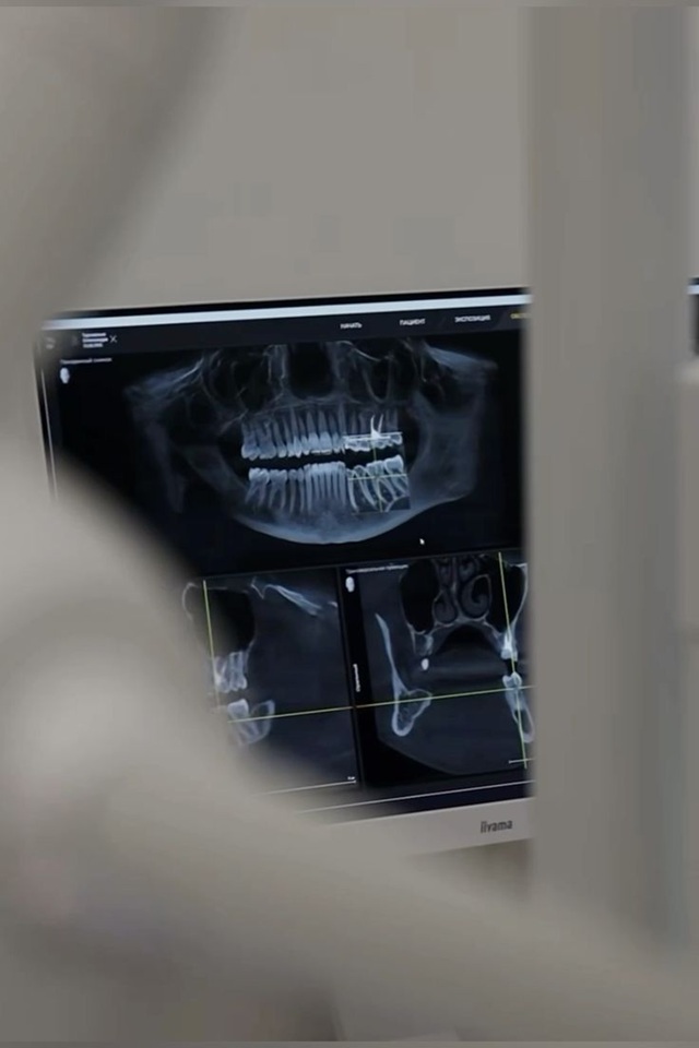 Radiografía panorámica mostrada en un monitor clínico